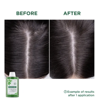 Klorane Champú Ortiga 200 ml - Champú | STG Farma