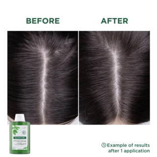 Klorane Champú Ortiga 400 ml - Champú | STG Farma