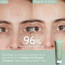 Vinopure Gelatina Limpiadora Purificante 200 ml Caudalie
