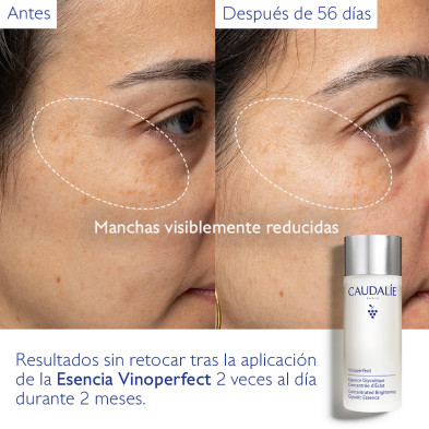 Caudalie Vinoperfect Esencia Glicólica 100 ml