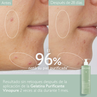 Caudalie Vinopure Gelatina Limpiadora 385 ml - Limpieza | STG Farma