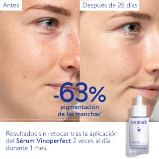 Caudalie Vinoperfect Sérum Antimanchas 50 ml - Serum antimanchas | STG Farma