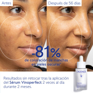 Caudalie Vinoperfect Sérum Antimanchas 50 ml - Serum antimanchas | STG Farma