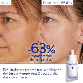 Caudalie Vinoperfect Sérum Antimanchas 50 ml - Serum antimanchas | STG Farma