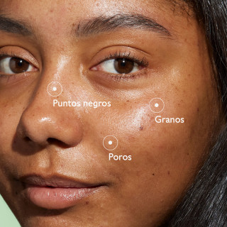 Caudalie Vinopure Sérum 30 ml - Serum para piel grasa | STG Farma