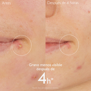 Caudalie Vinopure Stop Granos Salicílico 15 ml - Mascarillas y ampollas faciales | STG Farma