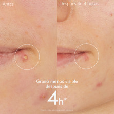 Caudalie Vinopure Stop Granos Salicílico 15 ml