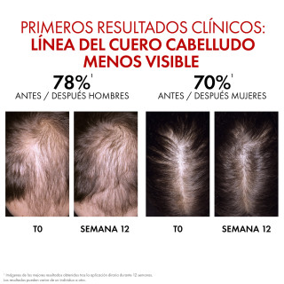 Vichy Dercos Aminexil Clinical Sérum Regen 90 ml - Tratamientos capilares | STG Farma