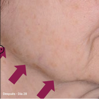 Primaderm Xpert Collageneur Cuello y Escote Reafirmante 50 ml - Cremas para cuello y escote | STG Farma