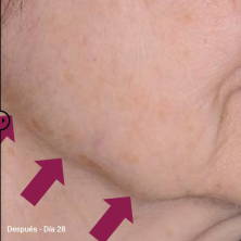 Primaderm Xpert Collageneur Cuello y Escote Reafirmante 50 ml