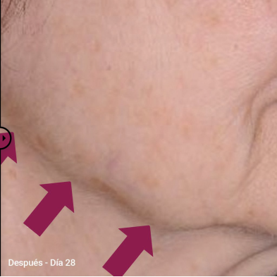 Primaderm Xpert Collageneur Cuello y Escote Reafirmante 50 ml