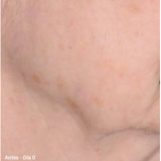 Primaderm Xpert Collageneur Cuello y Escote Reafirmante 50 ml - Cremas para cuello y escote | STG Farma