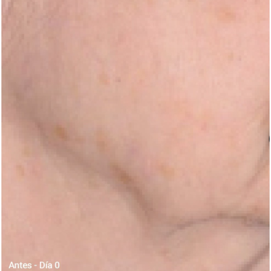 Primaderm Xpert Collageneur Cuello y Escote Reafirmante 50 ml