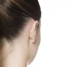 Otostick Corrector Orejas Separadas 8 unidades