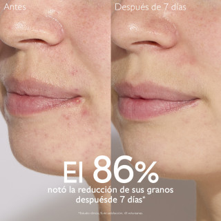 Caudalie Vinopure Rutina Granitos - Rutinas y packs | STG Farma