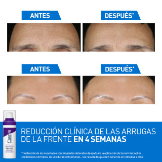 CeraVe Skin Renewing Sérum Retinol 30 ml - Sérum con Retinol | STG Farma