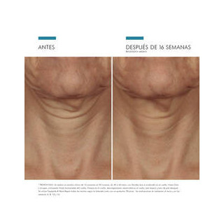 SkinCeuticals Tripeptide-R Neck Repair 50 ml - Cremas efecto lifting