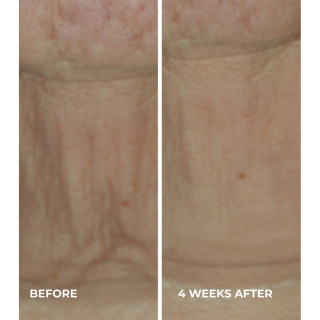 Roc Derm Correxion Firming Stick 30 gramos - Facial