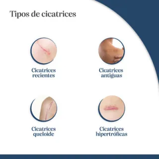 Trofolastin Parche Reductor Cicatrices Mamarias | Farmacia Tañá