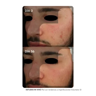 Gh Gema Herrerias Probioderm Balance 30 cápsulas - Facial