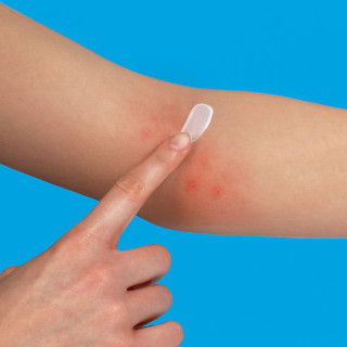 La Roche Posay Lipikar Eczema Med 30 ml - Hidratación corporal | STG Farma