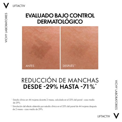 Vichy Liftactiv B3 Sérum Antimanchas 30 ml - manchas eficacia