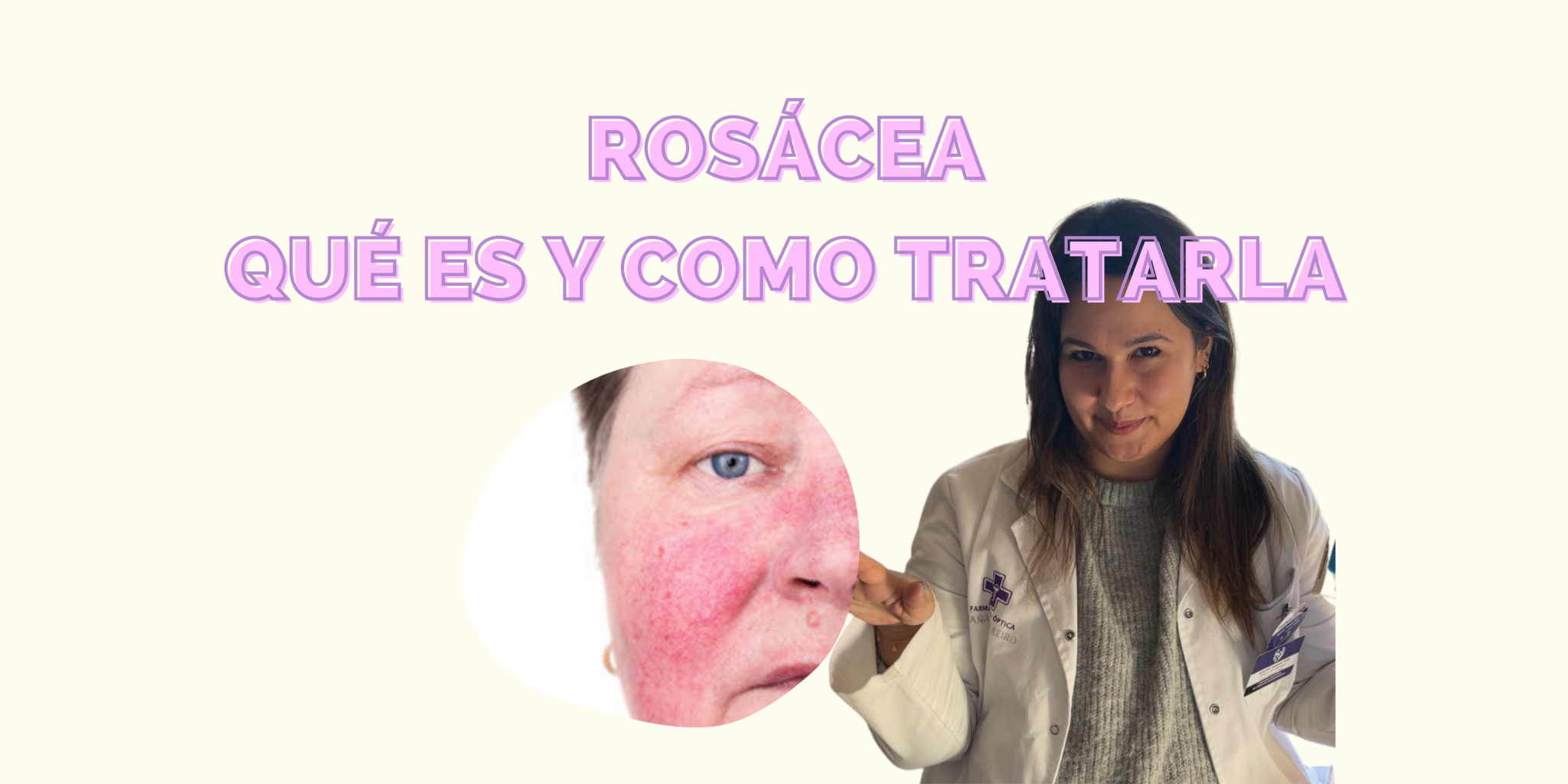 Rosácea, ¿sabes lo qué es?