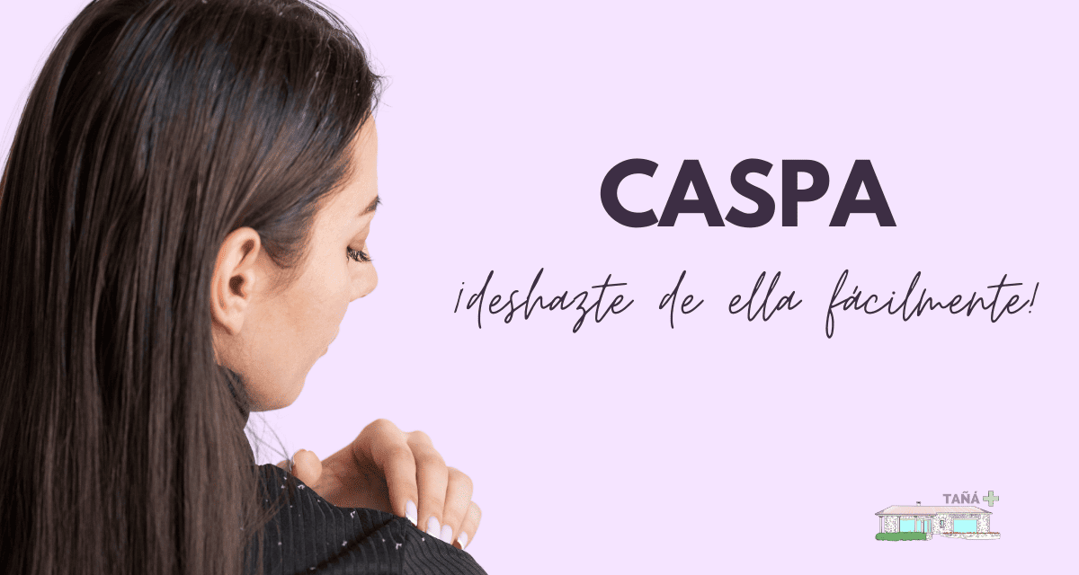 La caspa, un problema para el 50% de la población.