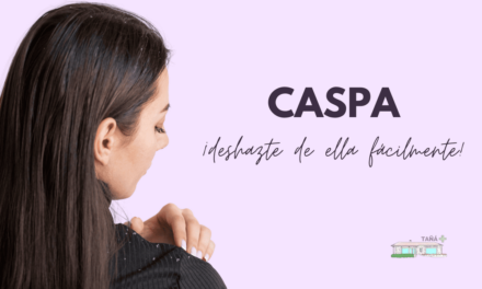 La caspa, un problema para el 50% de la población.