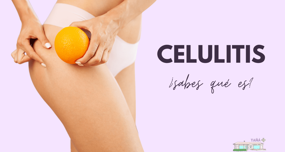 Celulitis, ¿sabes qué es?