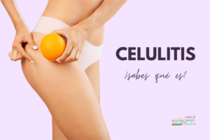 Celulitis, ¿sabes qué es?