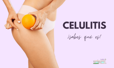 Celulitis, ¿sabes qué es?