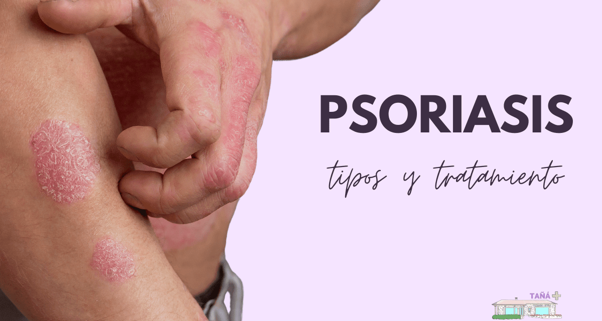 psoriasis pustulosa leve