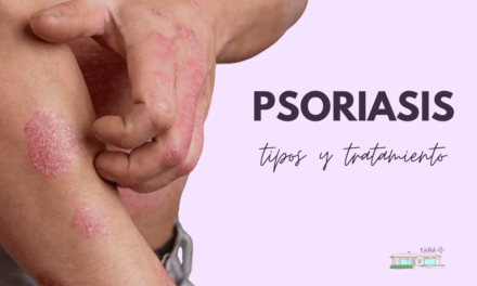 ¿Qué es la Psoriasis? Tipos y Tratamiento