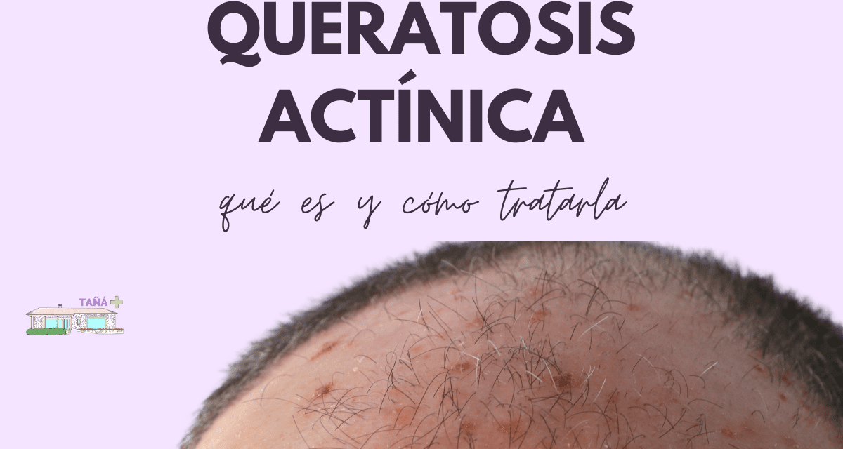 Queratosis actínica, ¿qué es?