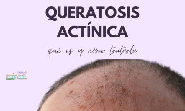 Queratosis actínica, ¿qué es?