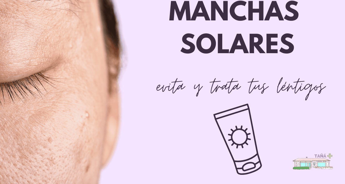 Manchas en la piel: manchas solares