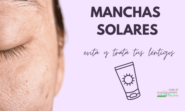 Manchas en la piel: manchas solares