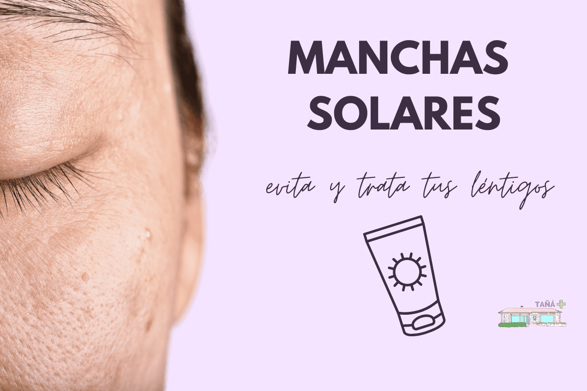 Manchas en la piel: manchas solares
