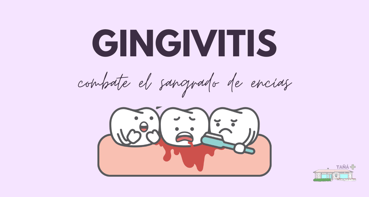 Gingivitis, cuando las encías sangran