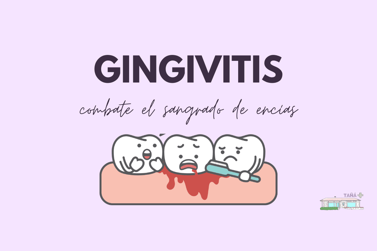 Gingivitis, cuando las encías sangran