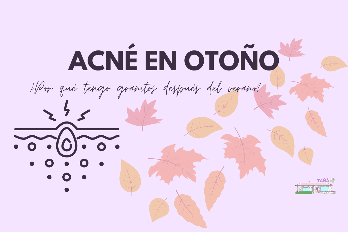 Acné en otoño