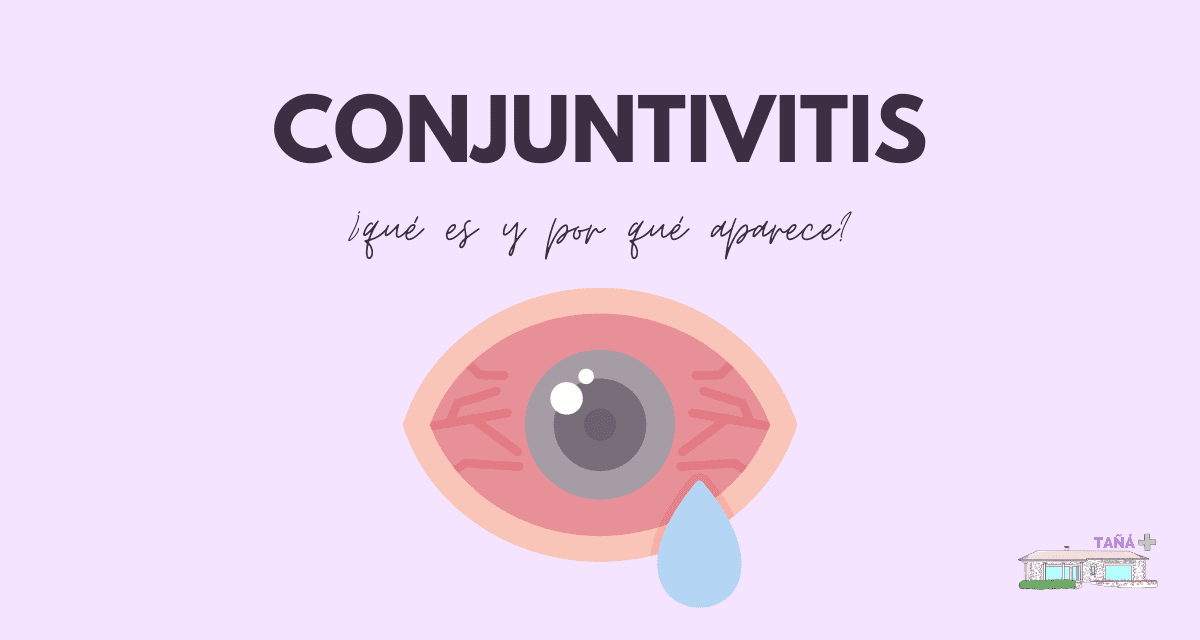 Conjuntivitis: tipos, tratamiento y cómo evitarlo