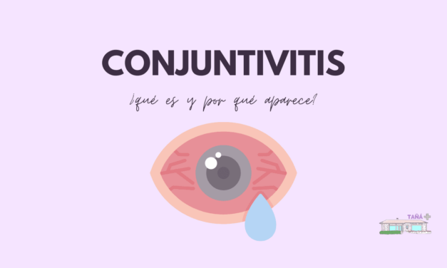 Conjuntivitis: tipos, tratamiento y cómo evitarlo