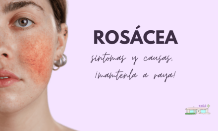 Rosácea: síntomas y causas