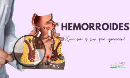 Síntomas y tratamiento adecuado de las hemorroides