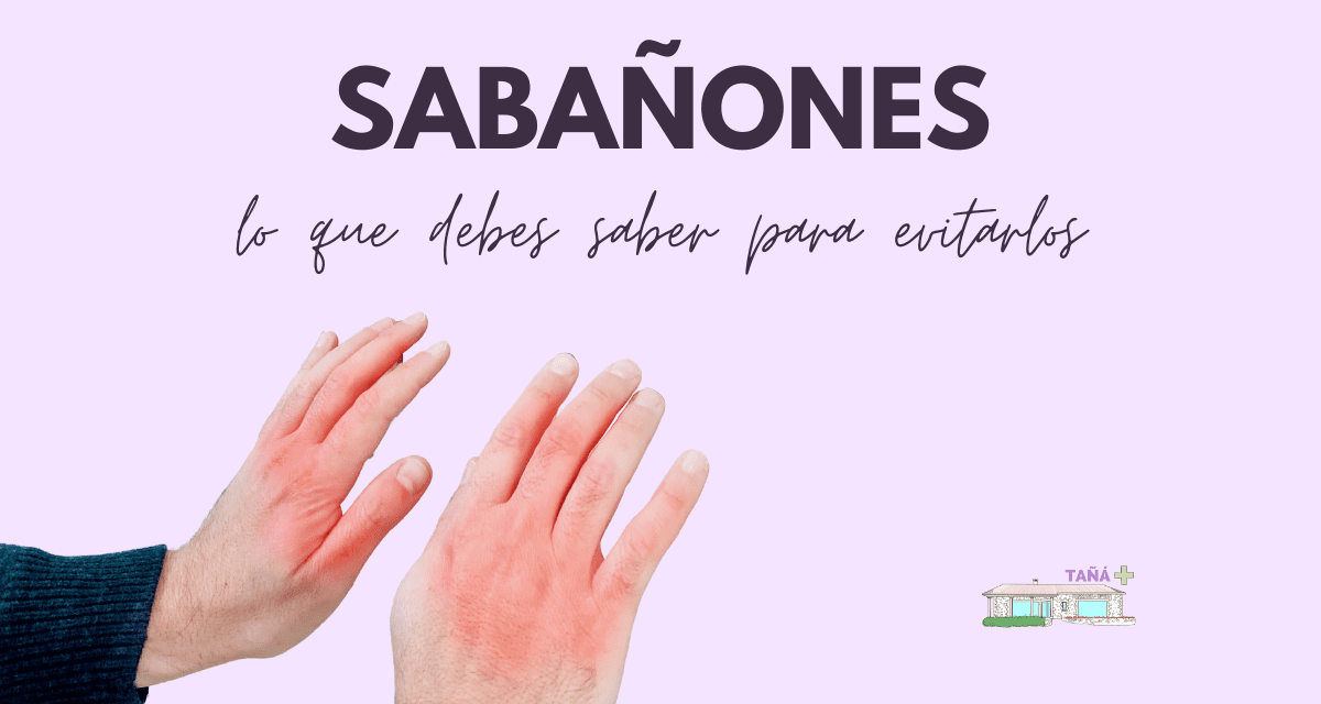 Todo lo que debes saber sobre los sabañones