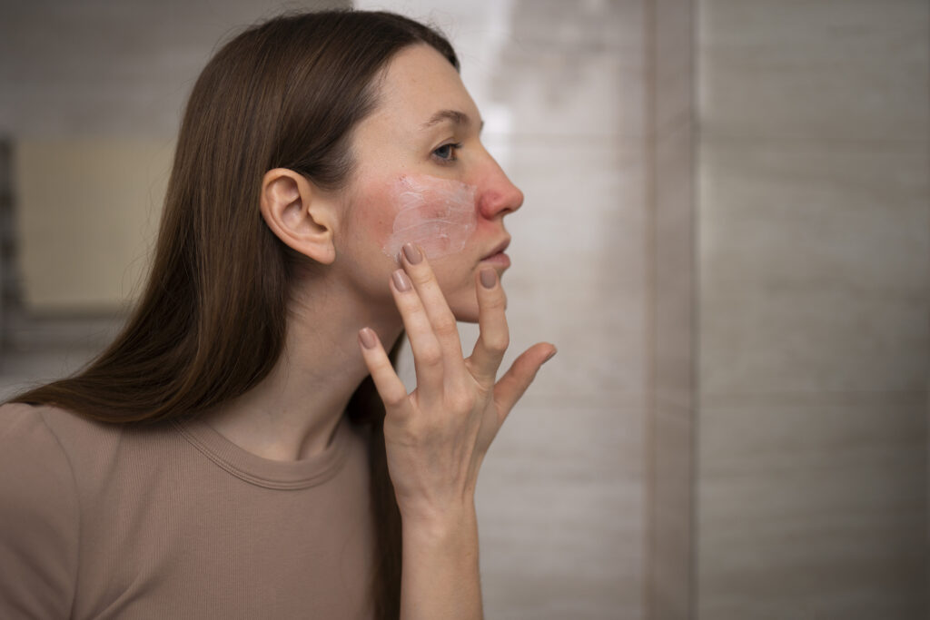 Dermatitis por estrés. Mujer con cremas intentando cuidar su piel irritada.