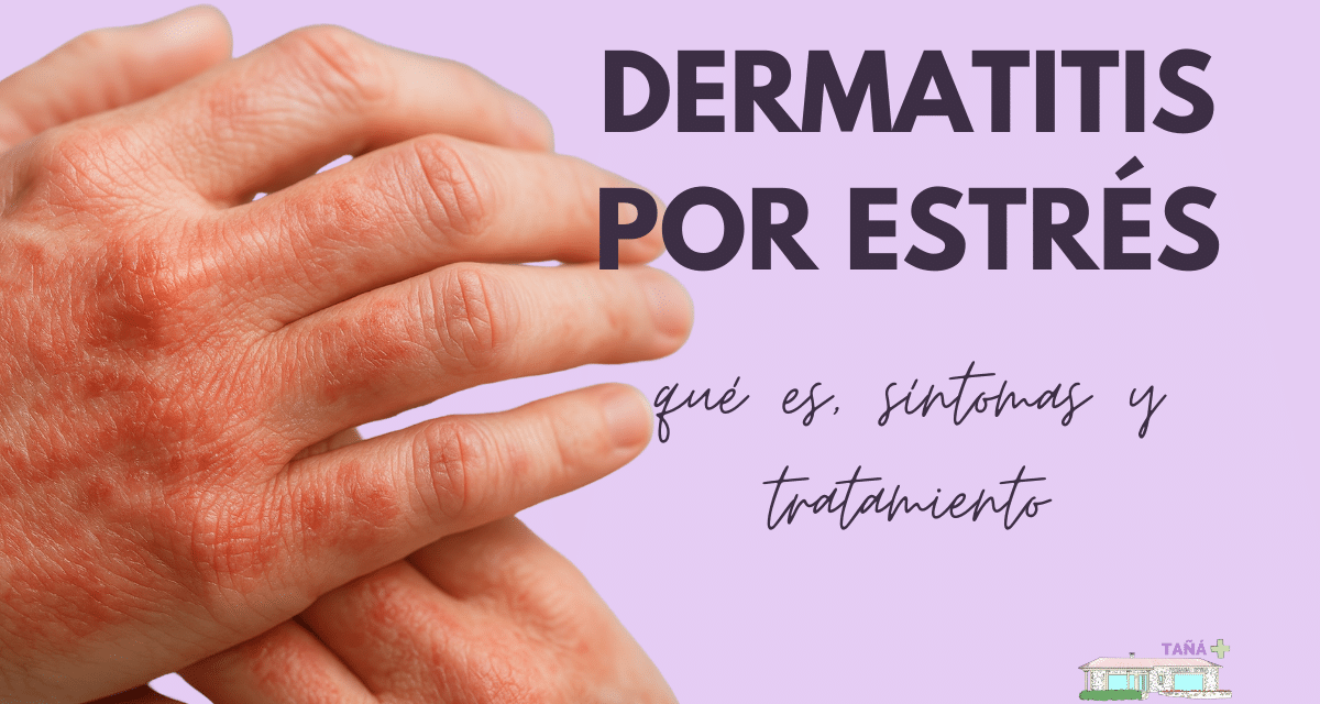 Dermatitis por estrés: qué es, síntomas y tratamiento