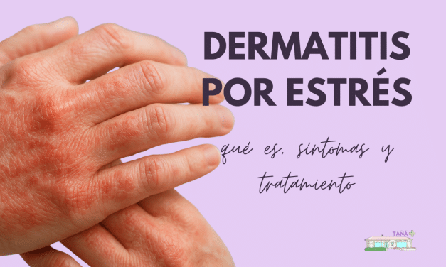 Dermatitis por estrés: qué es, síntomas y tratamiento
